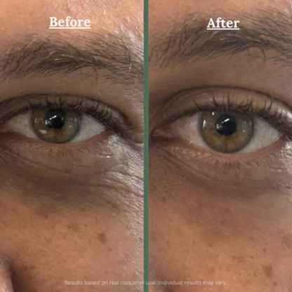 Brighter eyes in 10 minutes with cooling collagen patches
