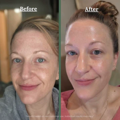 Brighter eyes in 10 minutes with cooling collagen patches